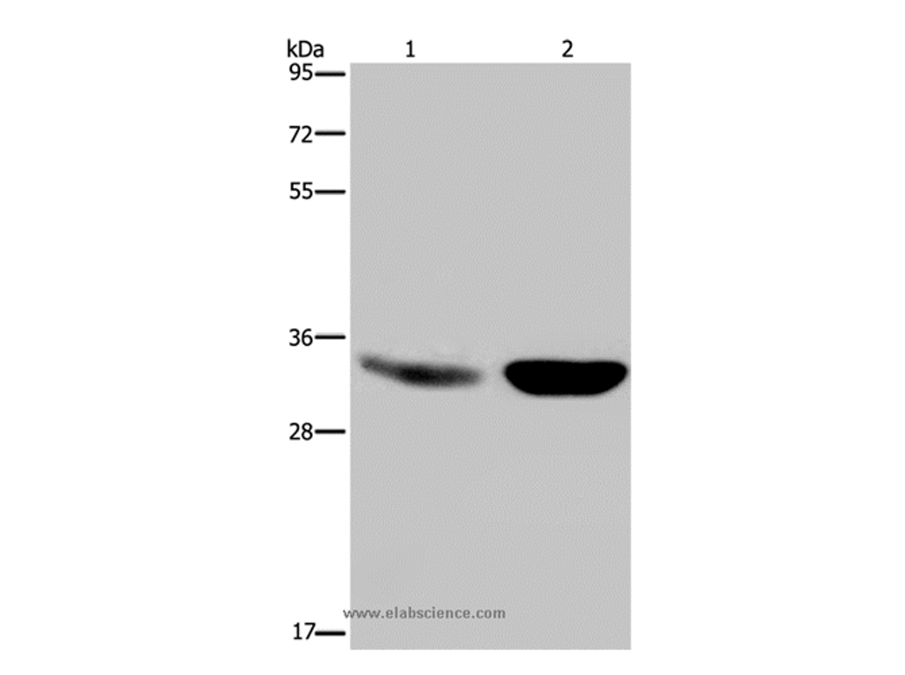 Western Blot analysis of Human fetal brain and Mouse brain tissue using MAPRE3 Polyclonal Antibody at dilution of 1:500