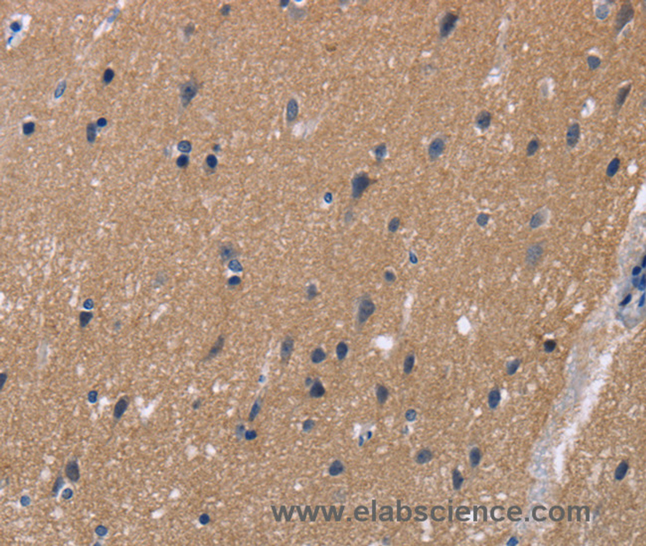 Immunohistochemistry of paraffin-embedded Human brain  tissue using KCNJ11 Polyclonal Antibody at dilution 1:40
