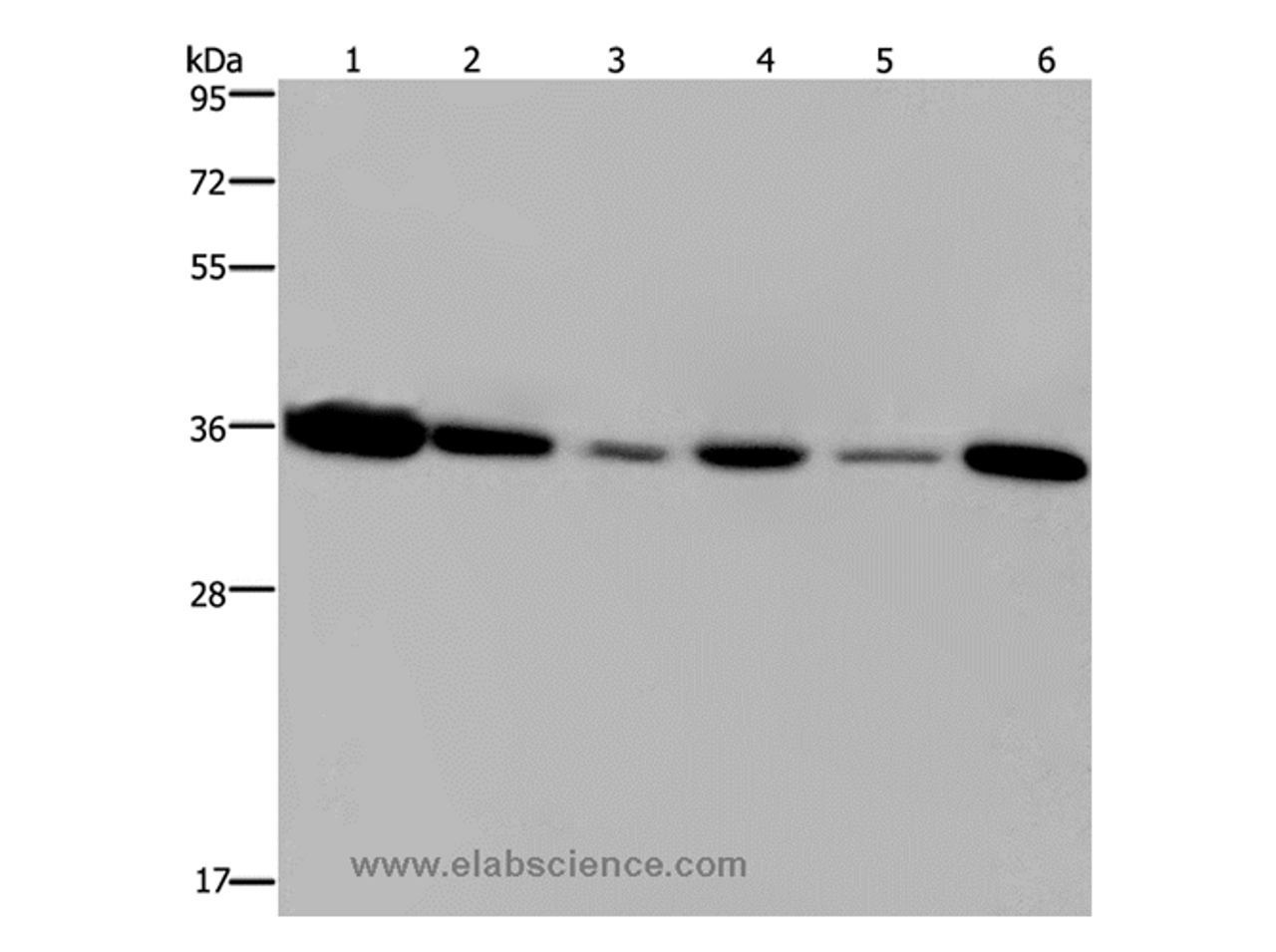Western Blot analysis of 293T and MCF-7 cell, Human hepatocellular carcinoma tissue and Raji cell, A431 and A549 cell   using EMD Polyclonal Antibody at dilution of 1:1200