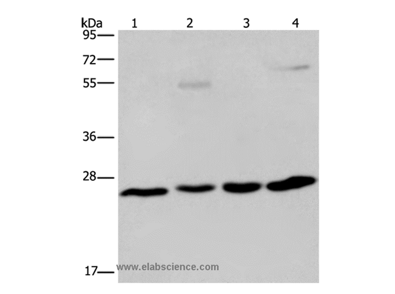 Western Blot analysis of A549 cell and Human hepatocellular carcinoma, Mouse liver tissue and HT-29 cell using ETHE1 Polyclonal Antibody at dilution of 1:400