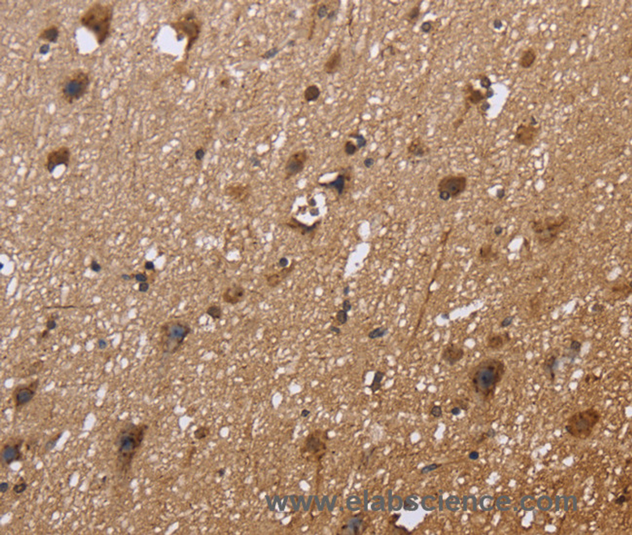 Immunohistochemistry of paraffin-embedded Human brain  tissue using EXTL3 Polyclonal Antibody at dilution 1:30