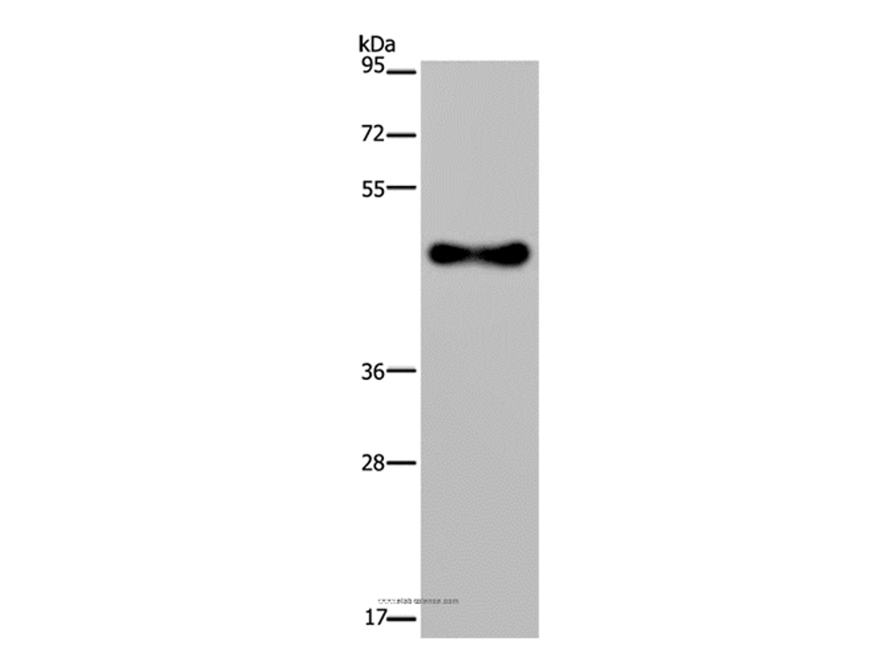 Western Blot analysis of Human fetal brain tissue using FADS1 Polyclonal Antibody at dilution of 1:300