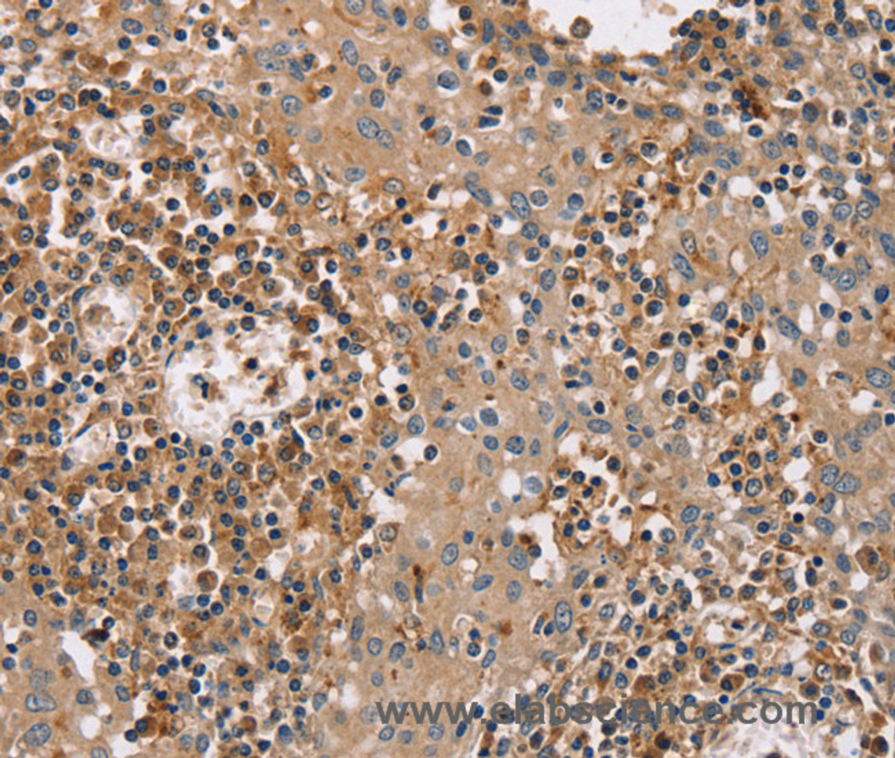 Immunohistochemistry of paraffin-embedded Human tonsil tissue using FAIM2 Polyclonal Antibody at dilution 1:40