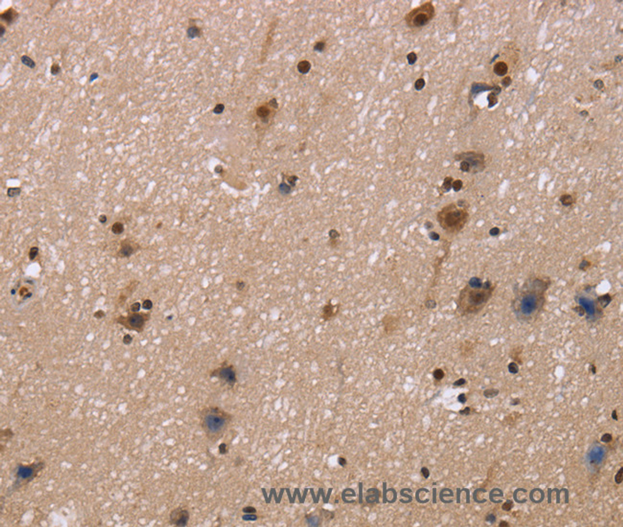 Immunohistochemistry of paraffin-embedded Human brain  tissue using FASTKD5 Polyclonal Antibody at dilution 1:40