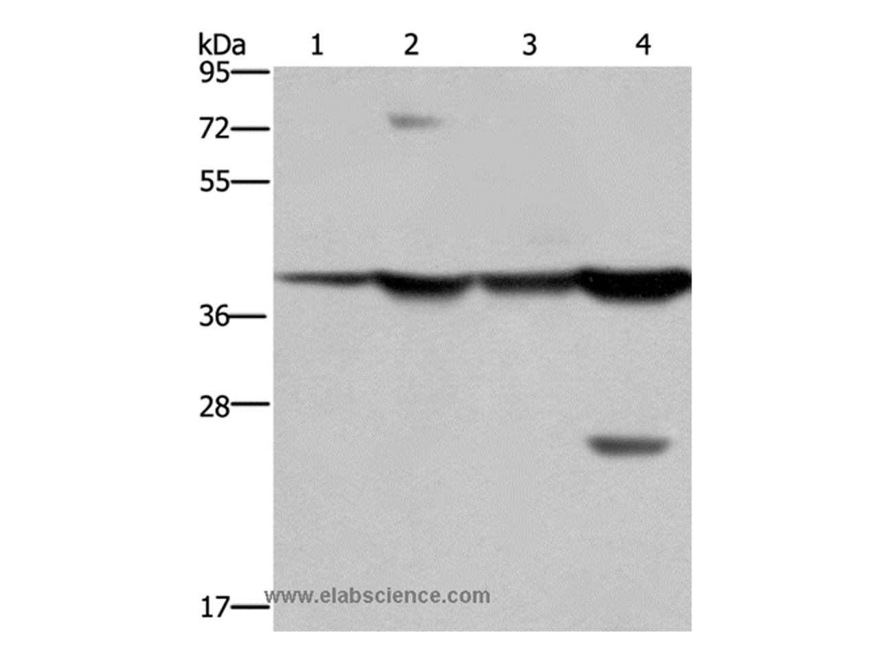 Western Blot analysis of Mouse stomach and Human fetal liver tissue, MCF-7 cell and Mouse liver tissue using FBP1 Polyclonal Antibody at dilution of 1:850