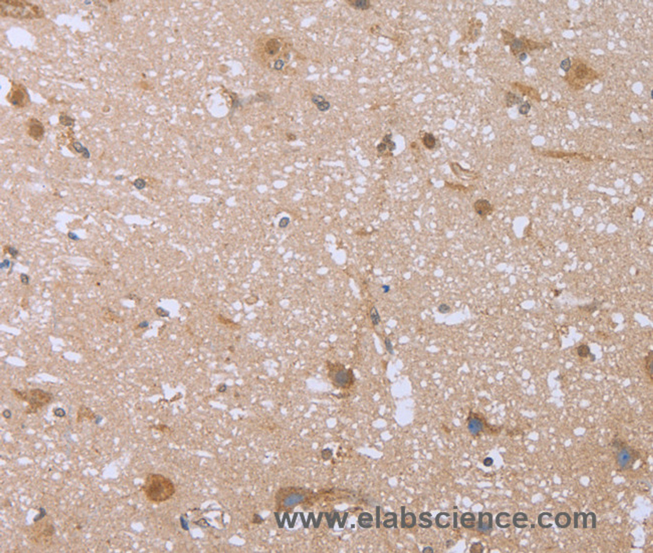 Immunohistochemistry of paraffin-embedded Human brain  using FHL2 Polyclonal Antibody at dilution of 1:40