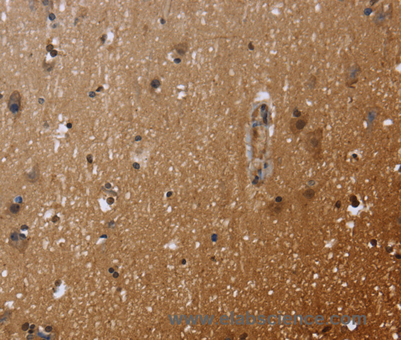 Immunohistochemistry of paraffin-embedded Human brain  using FHL3 Polyclonal Antibody at dilution of 1:40