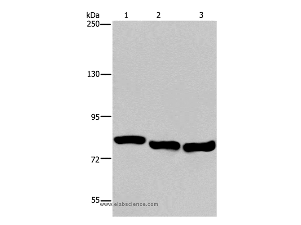 Western Blot analysis of A549, Hela and K562 cell using GAB2 Polyclonal Antibody at dilution of 1:300