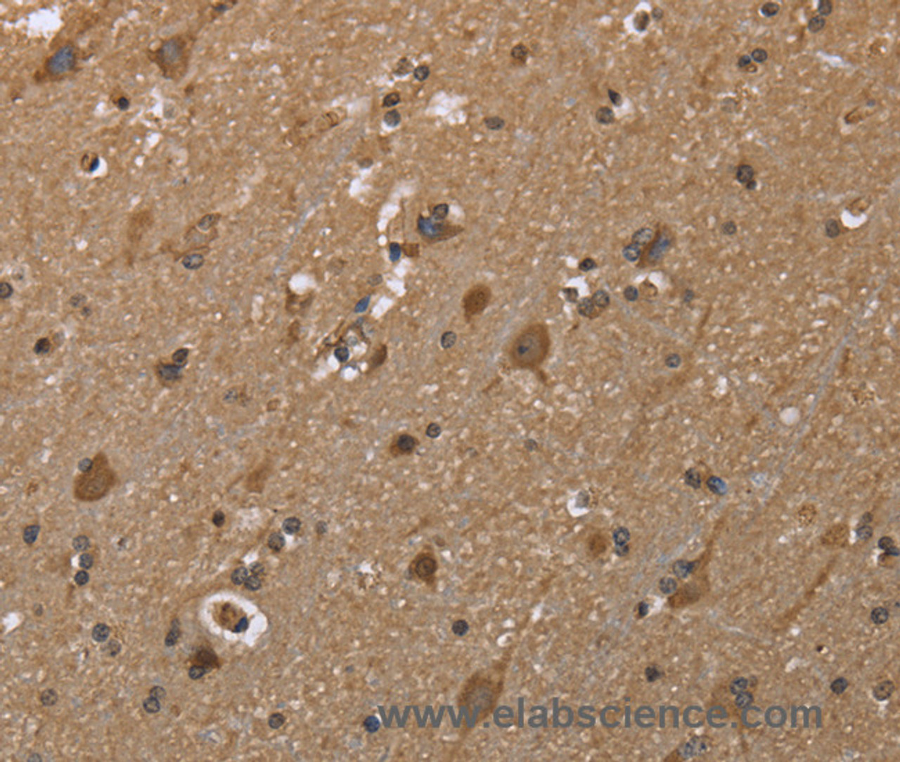 Immunohistochemistry of paraffin-embedded Human brain  using GALK1 Polyclonal Antibody at dilution of 1:40