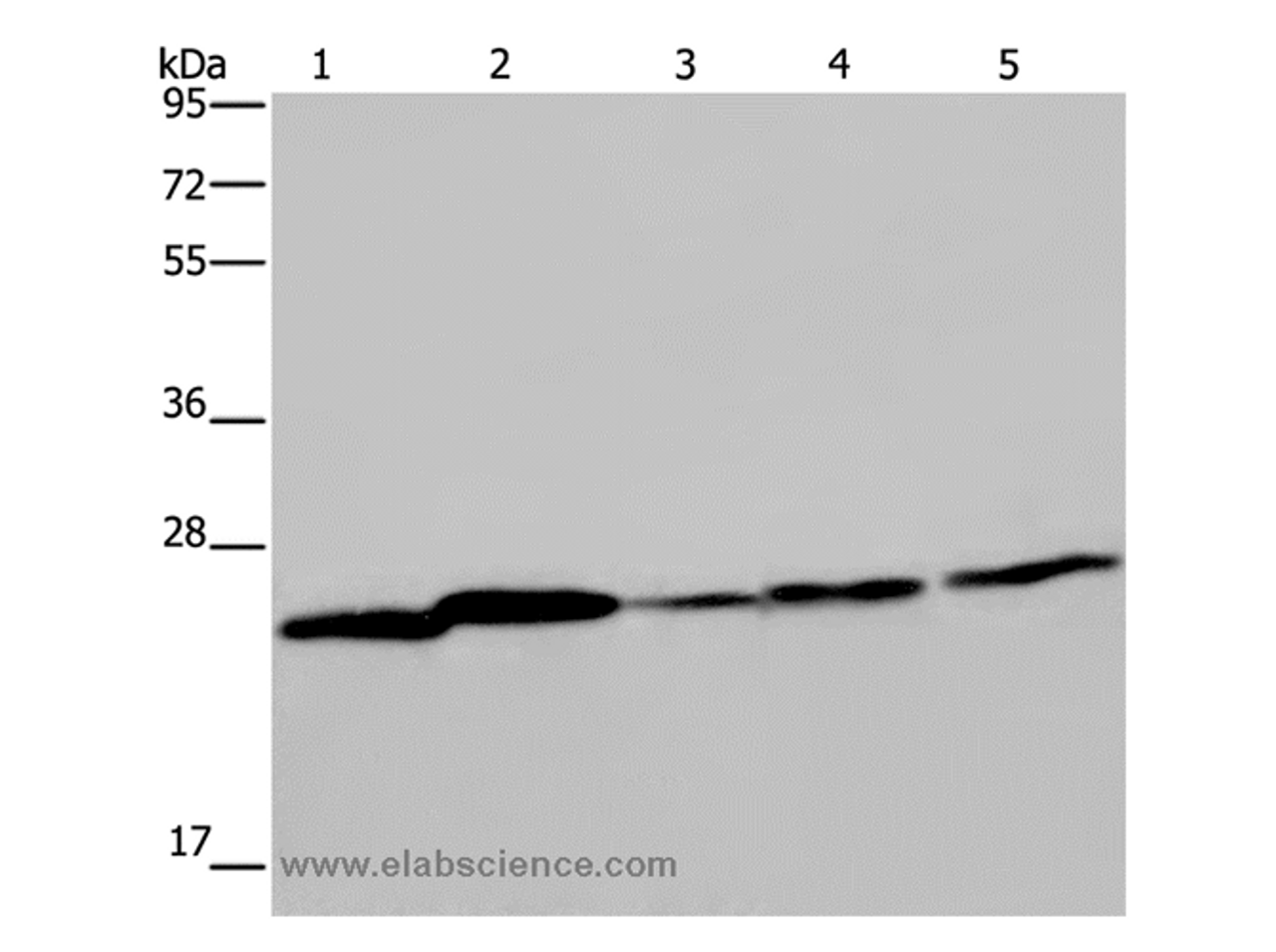 Western Blot analysis of Mouse spleen tissue, A375, A549, HT-29 and Hela cell using ARHGDIA Polyclonal Antibody at dilution of 1:350
