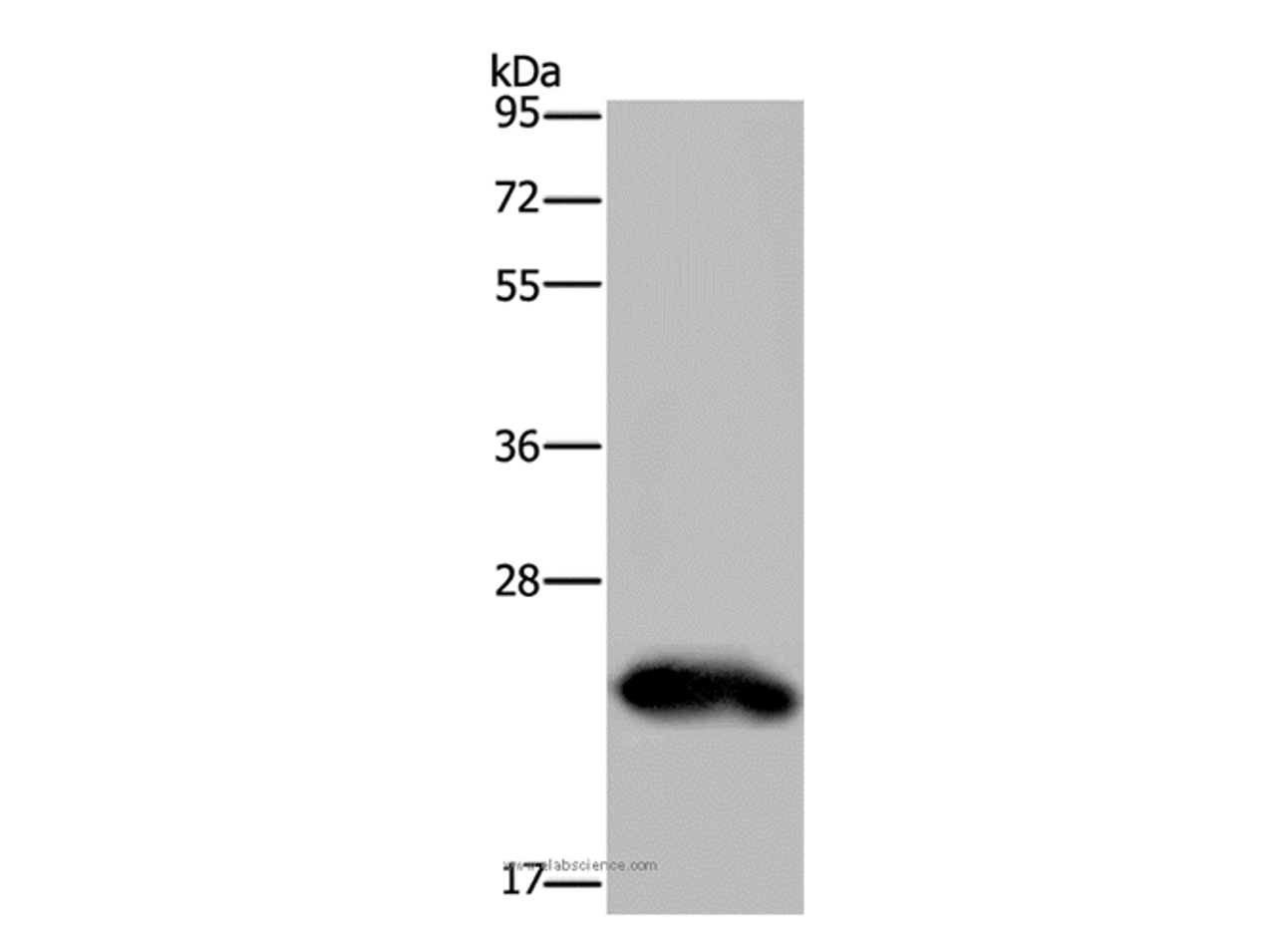 Western Blot analysis of Human placenta tissue using GH2 Polyclonal Antibody at dilution of 1:500