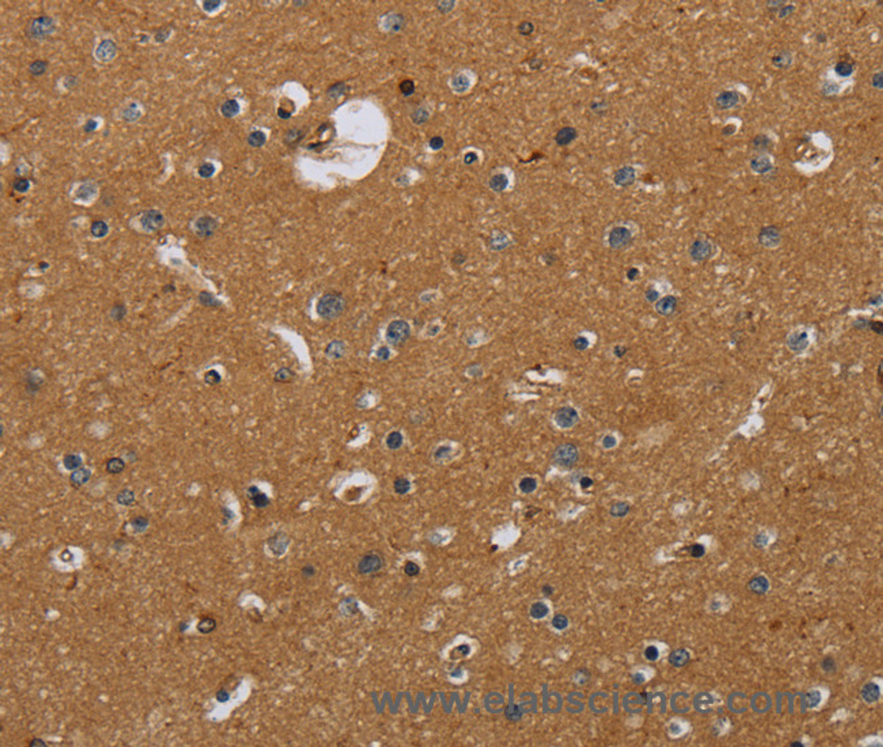 Immunohistochemistry of paraffin-embedded Human brain tissue using Glucocorticoid Receptor Polyclonal Antibody at dilution 1:40