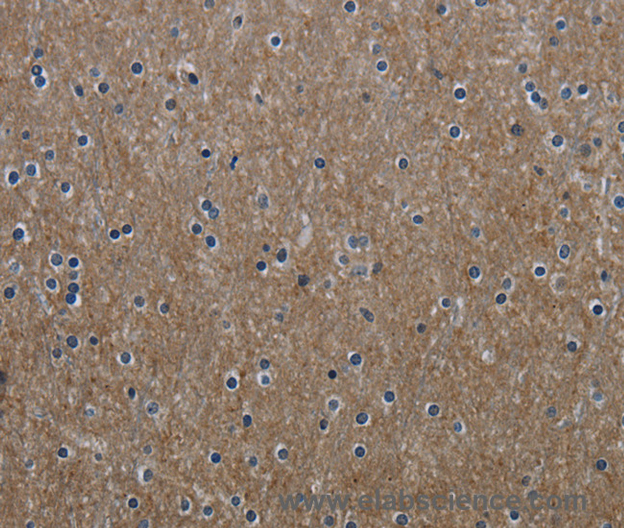 Immunohistochemistry of paraffin-embedded Human brain using GNG2 Polyclonal Antibody at dilution of 1:60