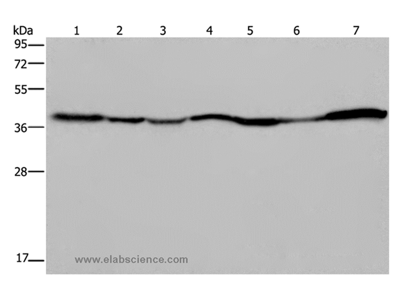 Western Blot analysis of 293T and Hela cell, Human fetal liver, Mouse spleen and heart tissue, Human fetal brain and hepatocellular carcinoma tissue  using GOT2 Polyclonal Antibody at dilution of 1:400