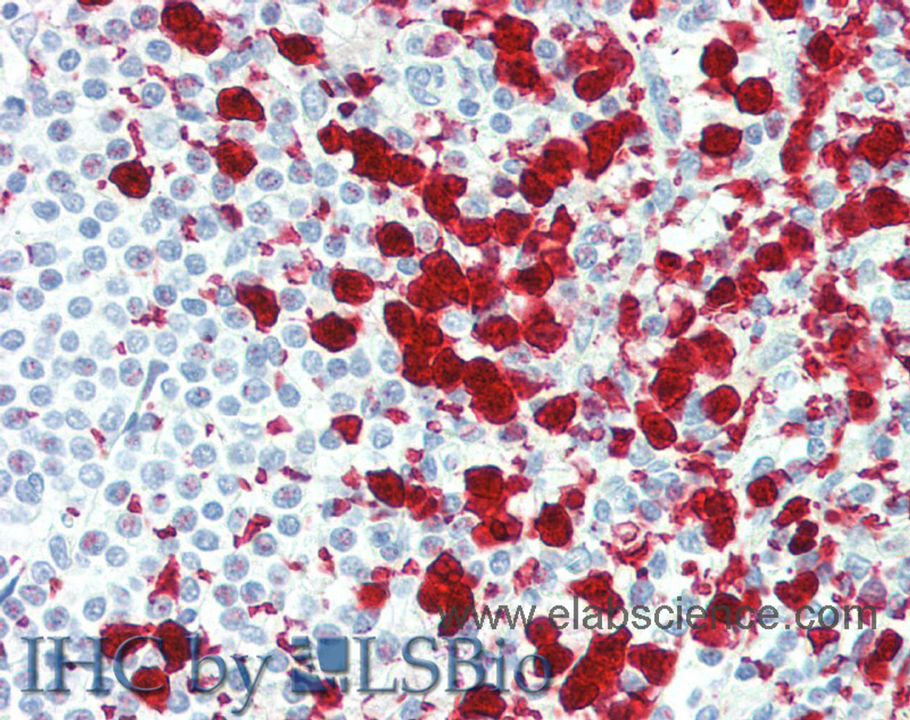 Immunohistochemistry of paraffin-embedded Spleen tissue using CD42b Polyclonal Antibody at dilution of 1:80(Elabscience® Product Detected by Lifespan).