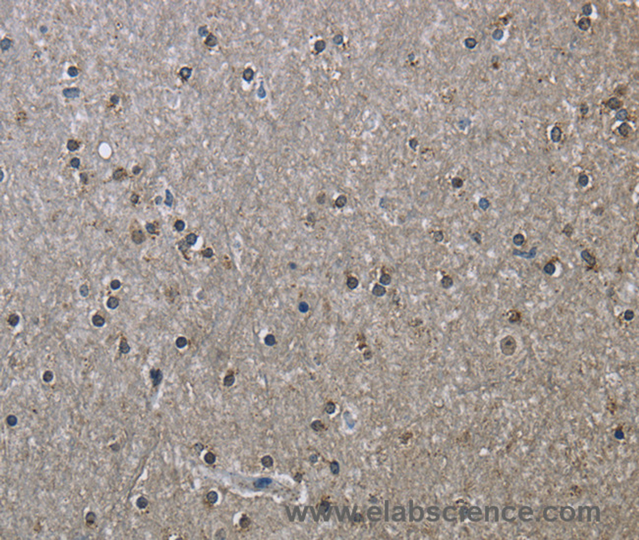 Immunohistochemistry of paraffin-embedded Human brain using HSPA9 Polyclonal Antibody at dilution of 1:50