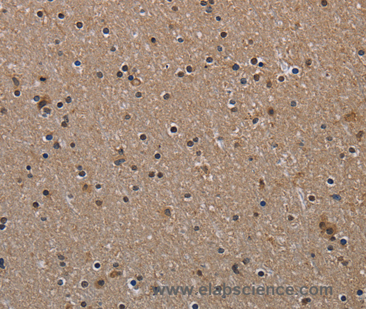 Immunohistochemistry of paraffin-embedded Human brain tissue using HIF1 alpha Polyclonal Antibody at dilution 1:60