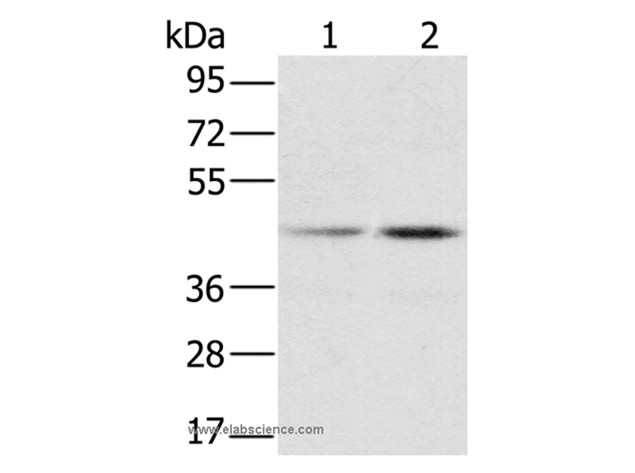 Western Blot analysis of Hela and K562 cell using hnRNP G Polyclonal Antibody at dilution of 1:800