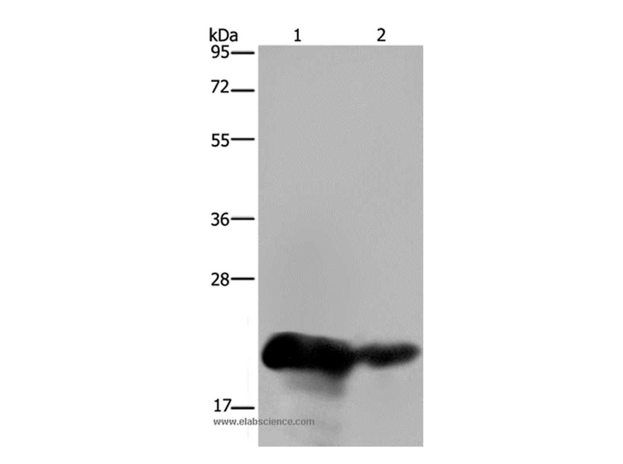 Western Blot analysis of Human placenta and breast infiltRative duct tissue using CSH1 Polyclonal Antibody at dilution of 1:200