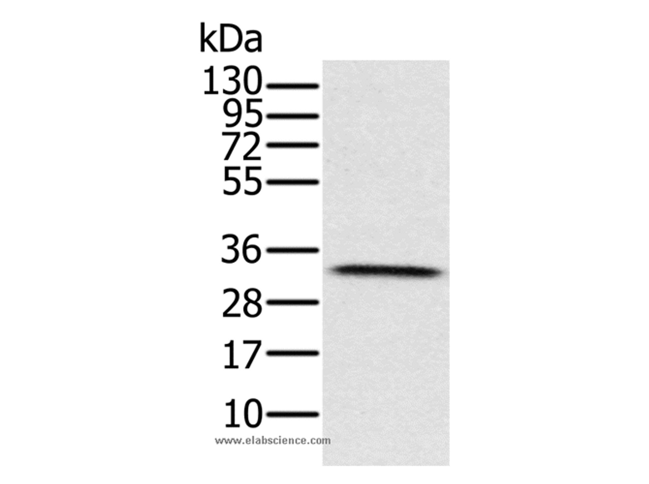 Western Blot analysis of Human testis tissue  using HSD17B8 Polyclonal Antibody at dilution of 1:650