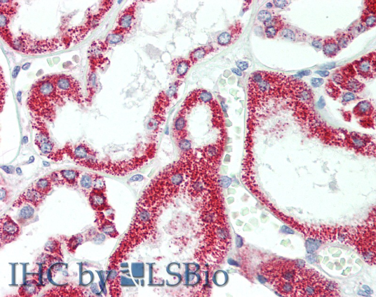Immunohistochemistry of paraffin-embedded Human Kidney using HSD17B8 Polyclonal Antibody at dilution of 1:100(Elabscience® Product Detected by Lifespan).