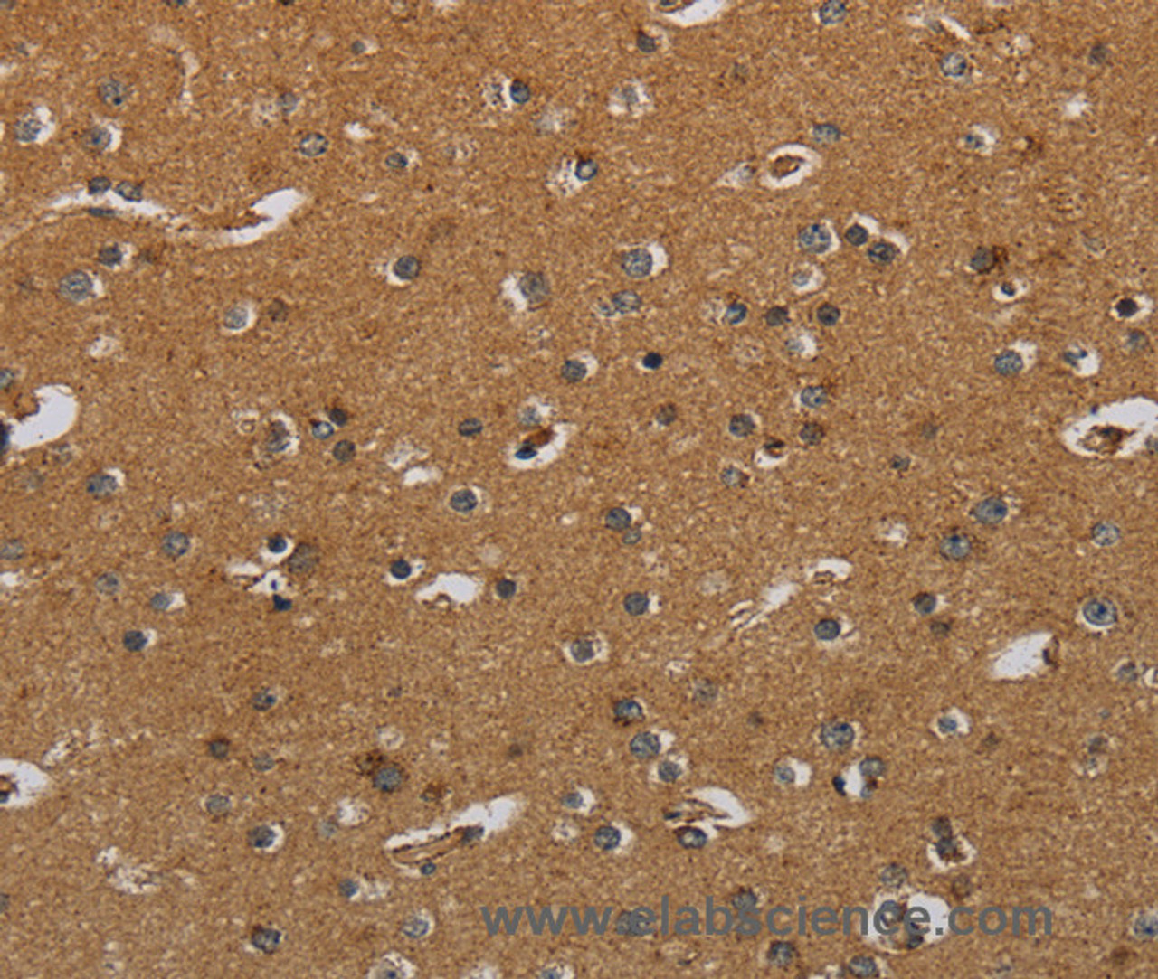 Immunohistochemistry of paraffin-embedded Human brain  using HSD17B2 Polyclonal Antibody at dilution of 1:50