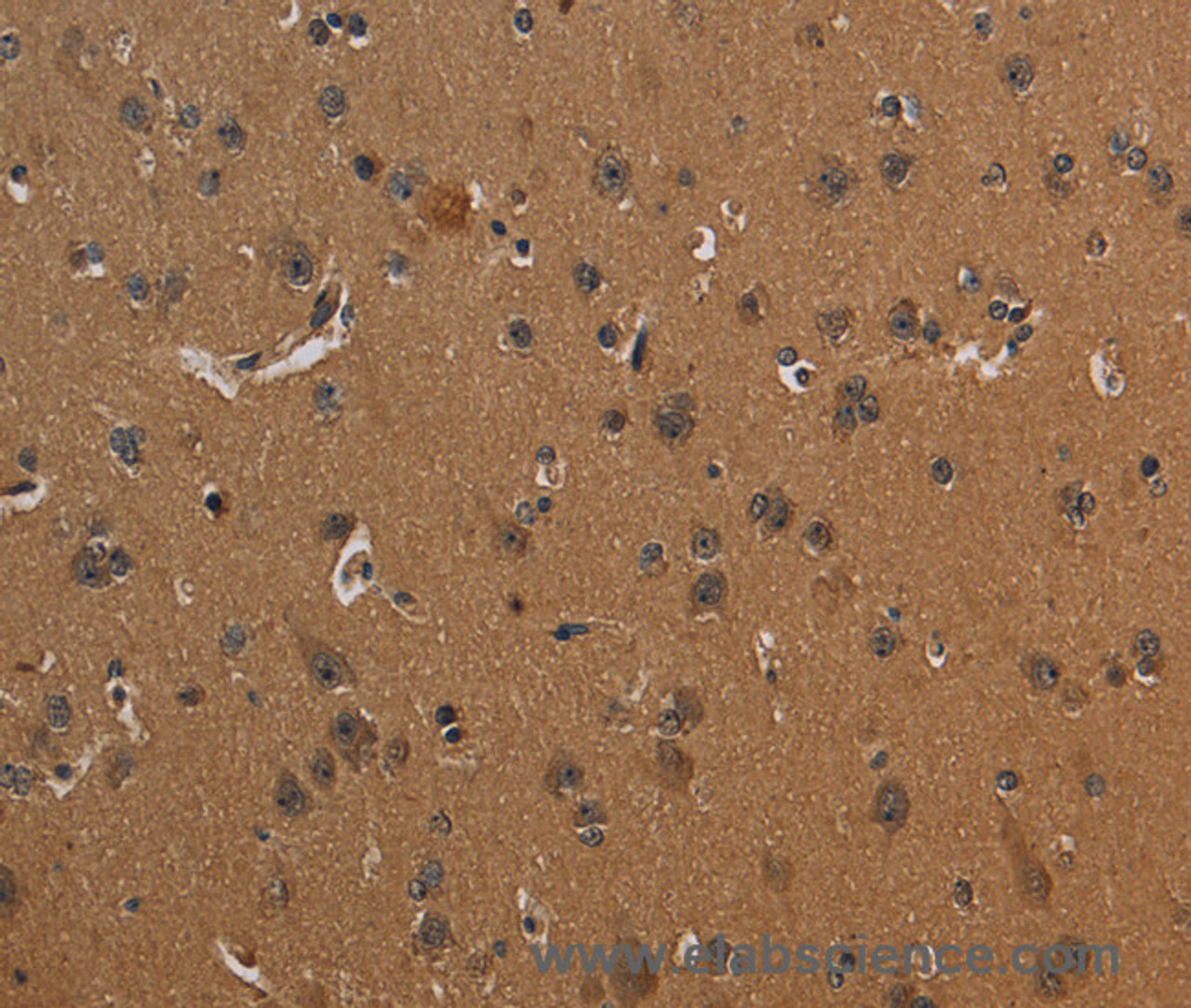 Immunohistochemistry of paraffin-embedded Human brain tissue using CD242 Polyclonal Antibody at dilution 1:30