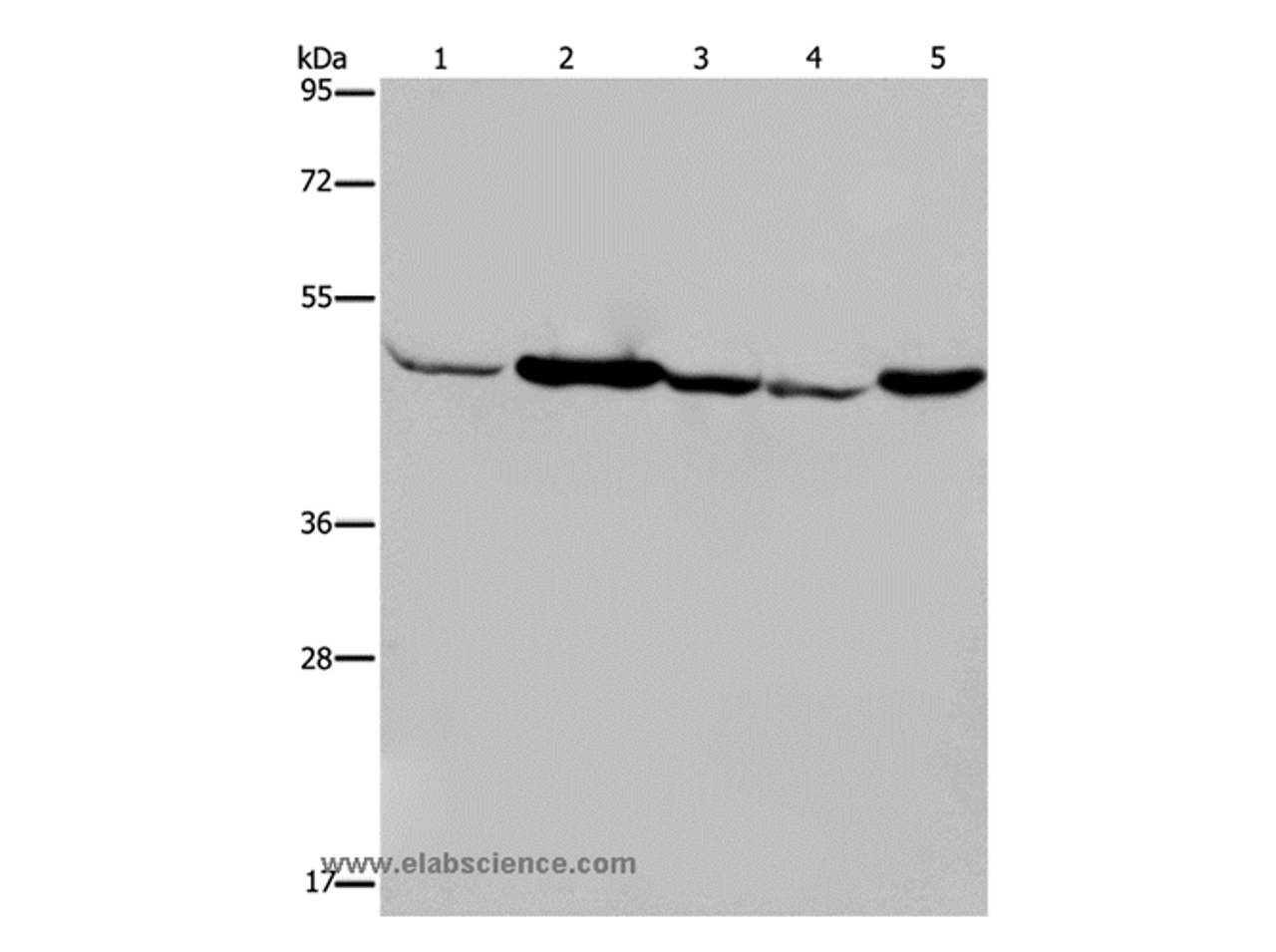 Western Blot analysis of Human fetal muscle tissue, Jurkat and 293T cell, Hela cell and Mouse liver tissue using IDH2 Polyclonal Antibody at dilution of 1:600