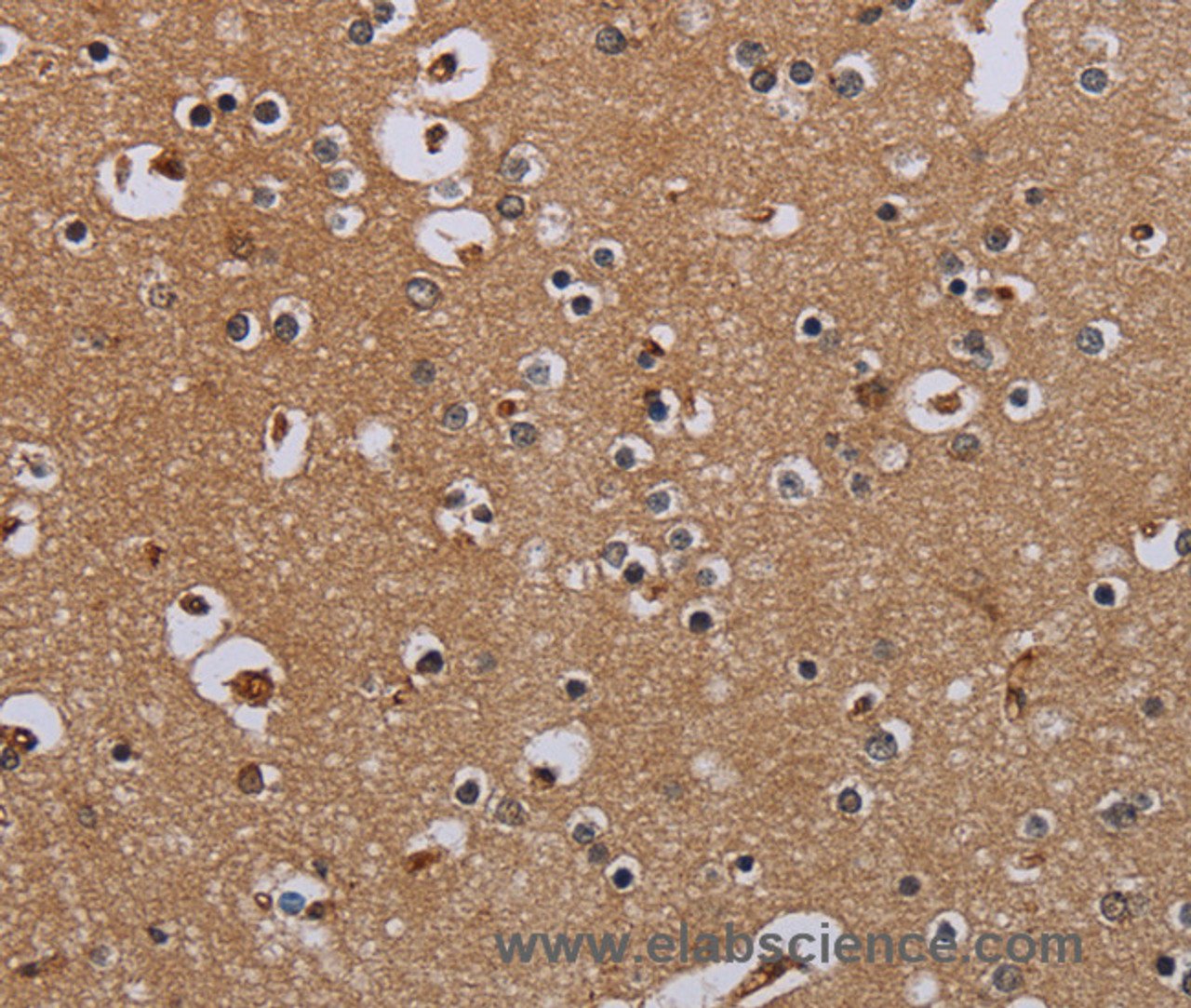 Immunohistochemistry of paraffin-embedded Human brain  tissue using IFRD1 Polyclonal Antibody at dilution 1:40