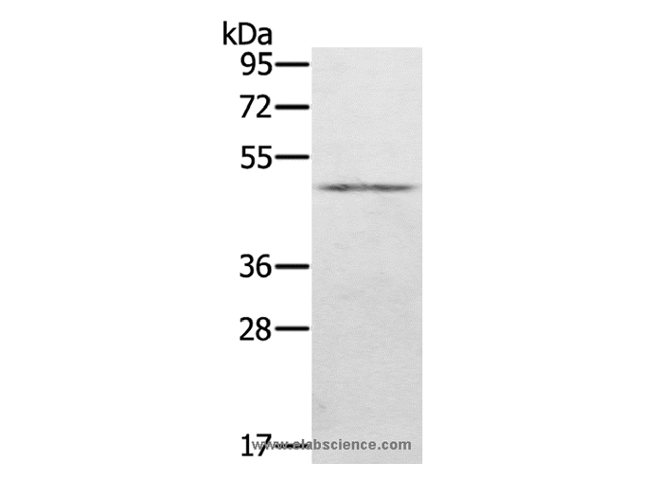 Western Blot analysis of Human normal stomach tissue using KDM8 Polyclonal Antibody at dilution of 1:500