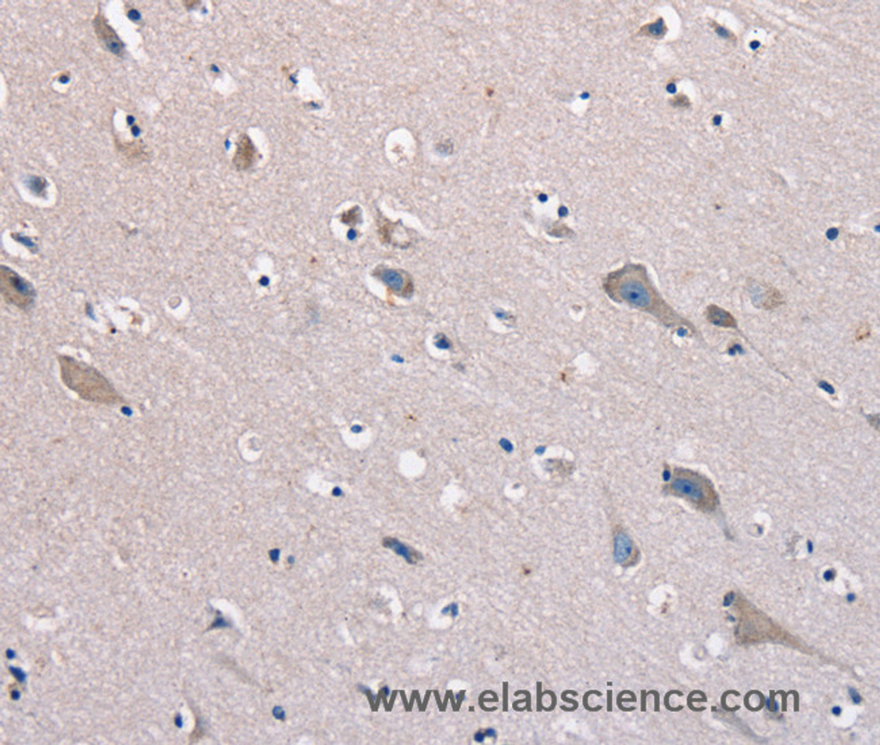 Immunohistochemistry of paraffin-embedded Human brain  tissue using KCNQ5 Polyclonal Antibody at dilution 1:60