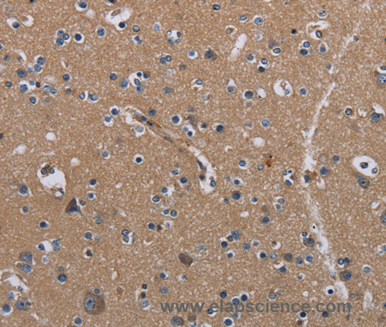 Immunohistochemistry of paraffin-embedded Human brain  tissue using PIDD1 Polyclonal Antibody at dilution 1:30