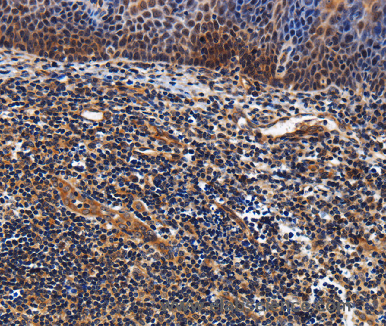 Immunohistochemistry of paraffin-embedded Human tonsil tissue using LRRC57 Polyclonal Antibody at dilution 1:40