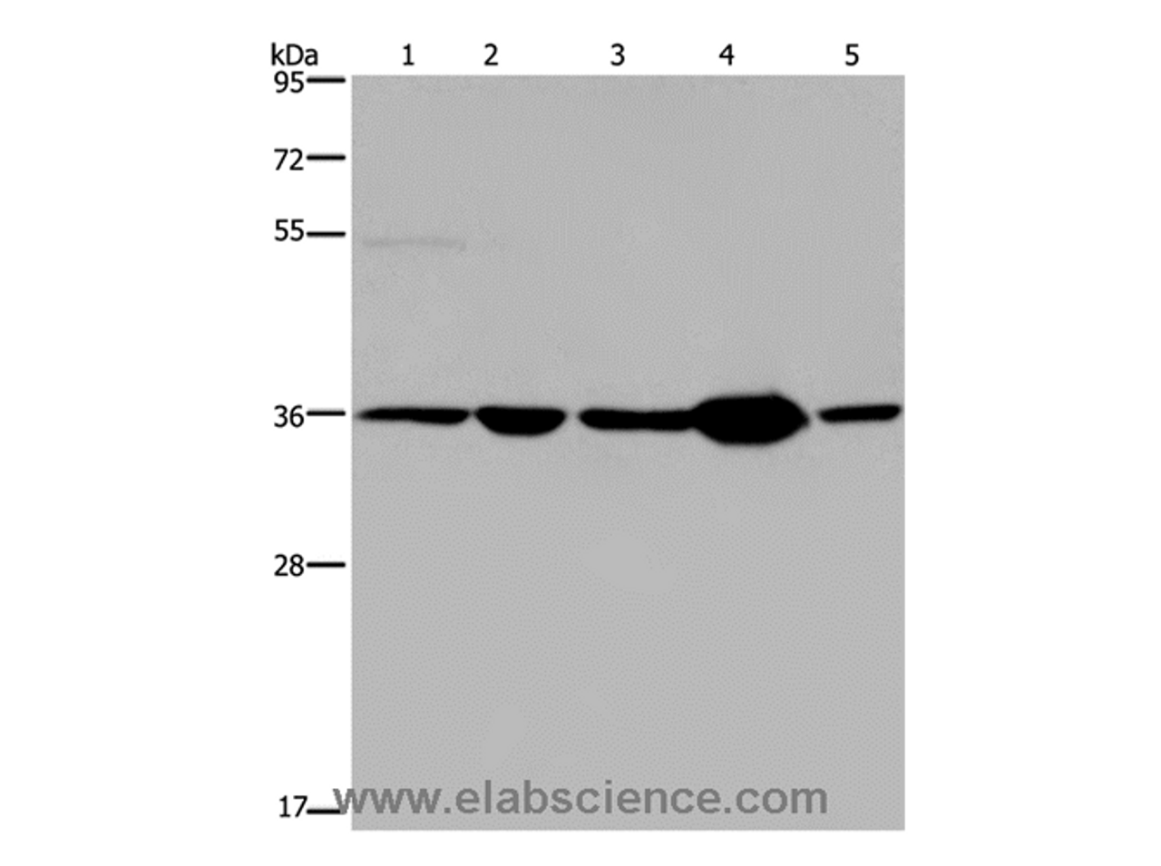 Western Blot analysis of Human transitional cell carcinoma tissue, 293T and A172 cell, Human testis tissue and Hela cell using LZTFL1 Polyclonal Antibody at dilution of 1:550