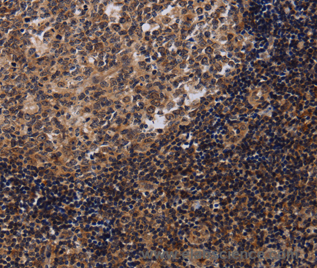 Immunohistochemistry of paraffin-embedded Human tonsil tissue using NTMT1 Polyclonal Antibody at dilution 1:40