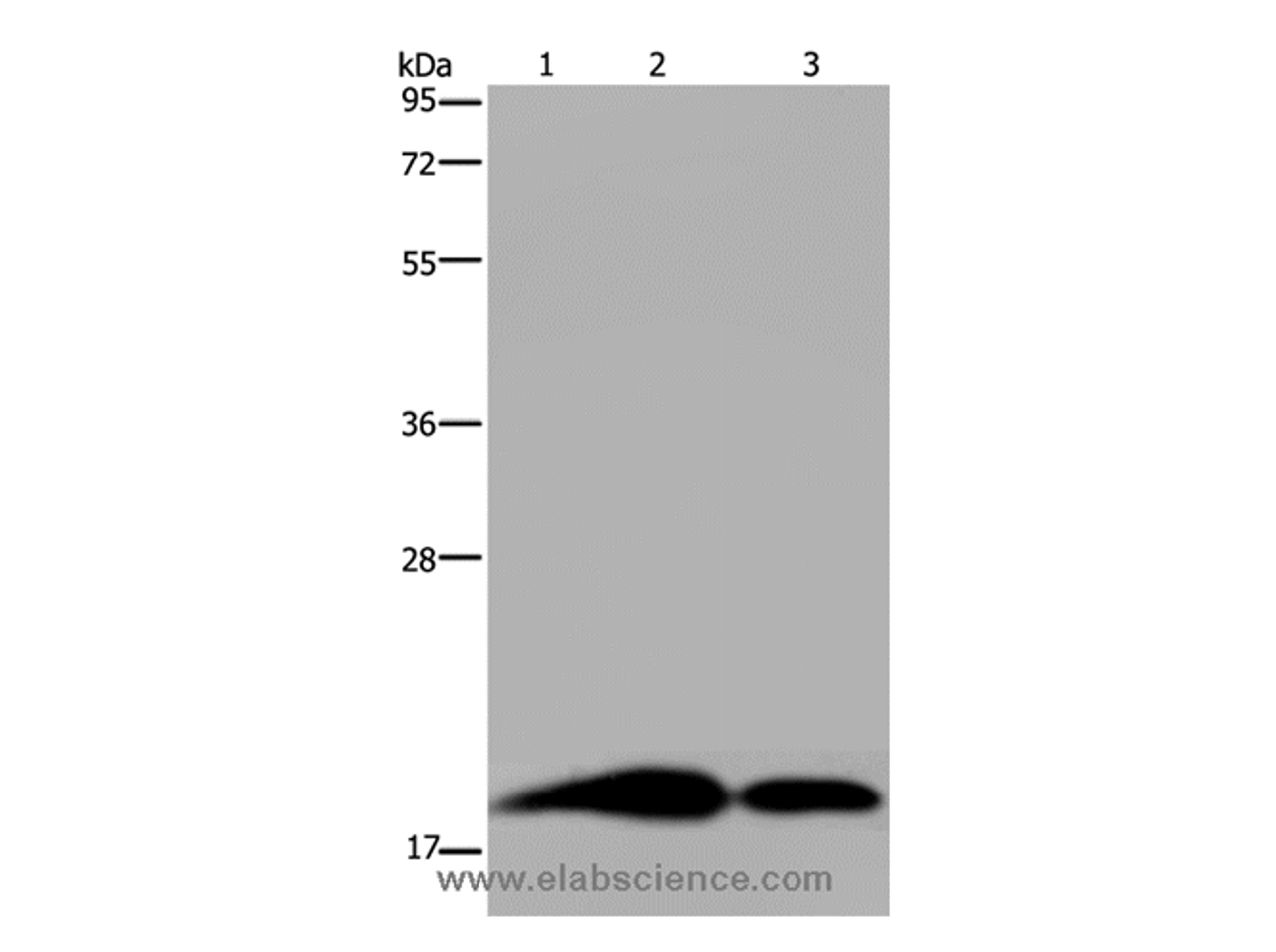 Western Blot analysis of Human brain malignant glioma, Mouse kidney and Human kidney tissue using REG3G Polyclonal Antibody at dilution of 1:250