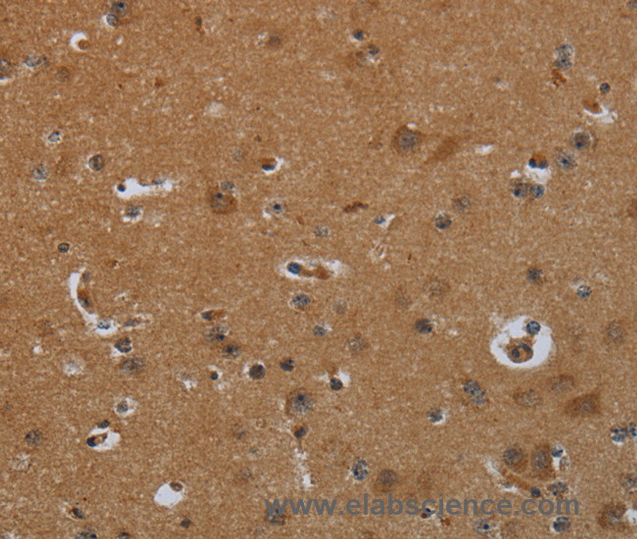 Immunohistochemistry of paraffin-embedded Human brain  tissue using ENTPD7 Polyclonal Antibody at dilution 1:60