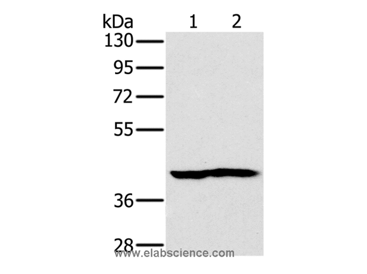 Western Blot analysis of Mouse heart and kidney tissue using NDUFA10 Polyclonal Antibody at dilution of 1:450