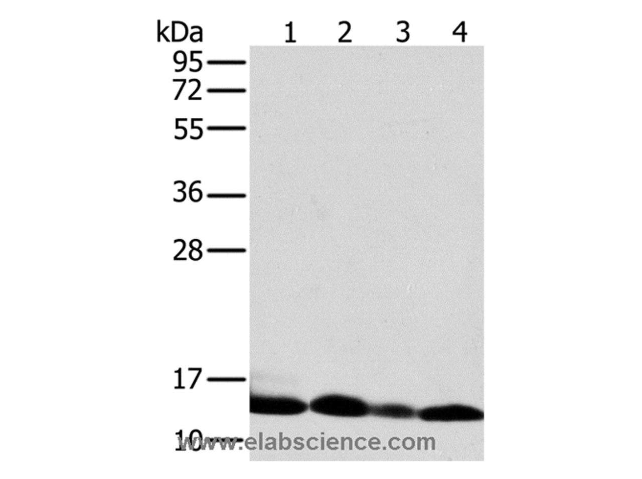 Western Blot analysis of Human liver tissue and K562 cell, Human fetal brain tissue and Raji cell using NDUFS5 Polyclonal Antibody at dilution of 1:400