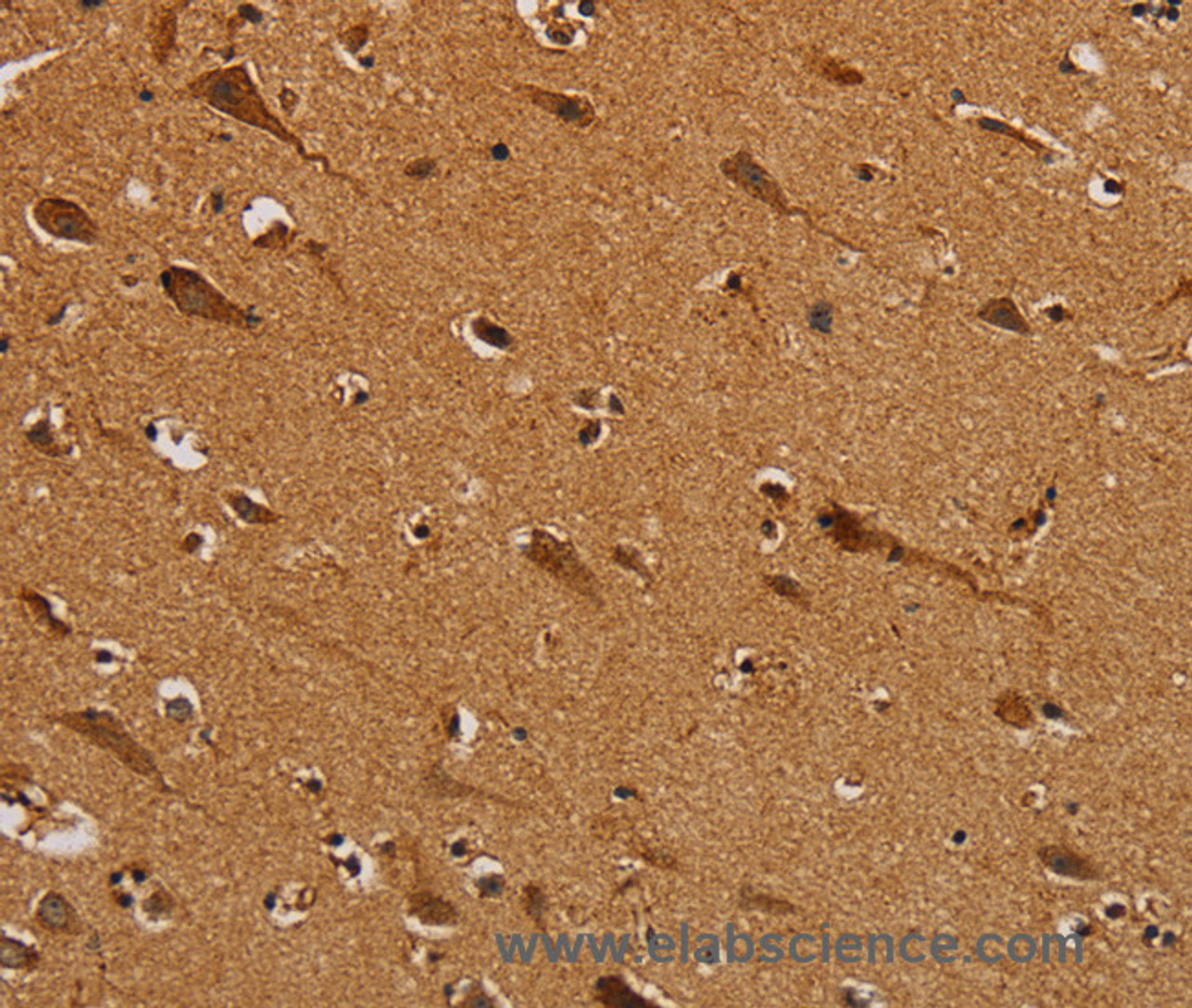 Immunohistochemistry of paraffin-embedded Human brain  using NDUFS5 Polyclonal Antibody at dilution of 1:50