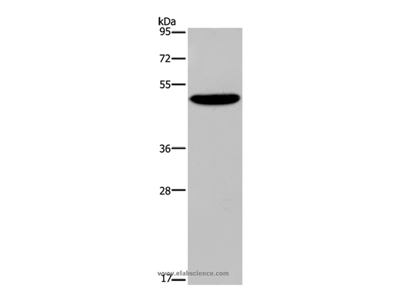 Western Blot analysis of SKOV3 cell using NECTIN4 Polyclonal Antibody at dilution of 1:350
