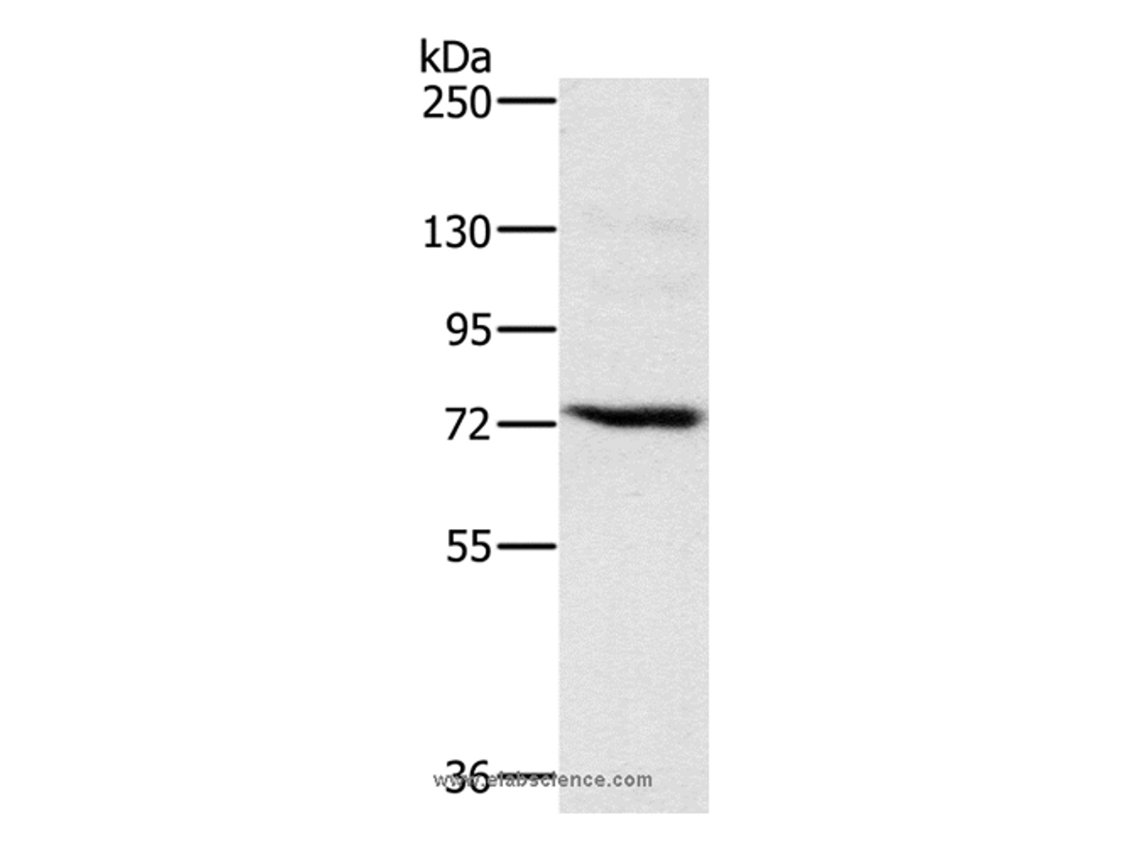 Western Blot analysis of Jurkat cell using NCSTN Polyclonal Antibody at dilution of 1:500