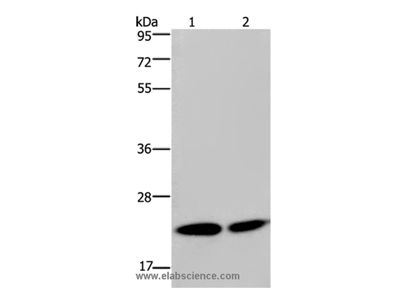 Western Blot analysis of Hela and Jurkat cell using NPM3 Polyclonal Antibody at dilution of 1:300