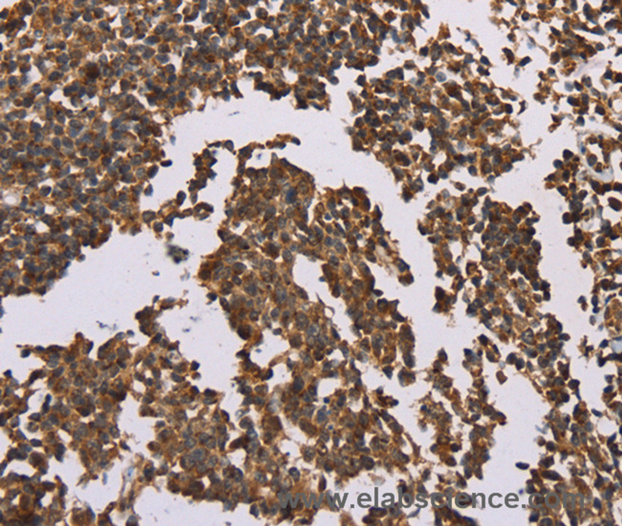 Immunohistochemistry of paraffin-embedded Human tonsil using OTC Polyclonal Antibody at dilution of 1:50