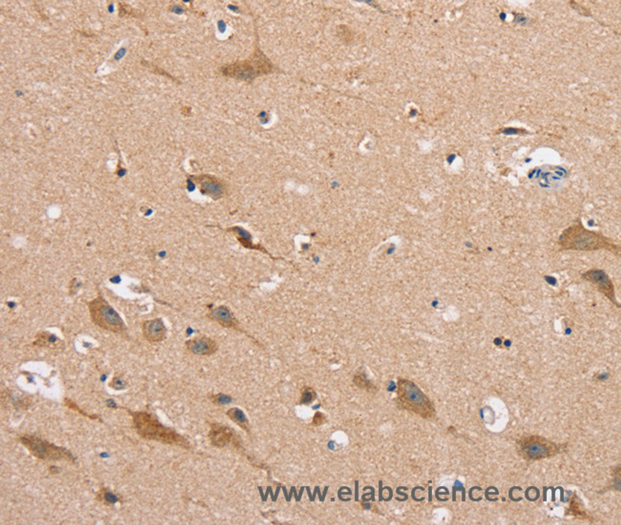 Immunohistochemistry of paraffin-embedded Human brain  using MSMB Polyclonal Antibody at dilution of 1:30