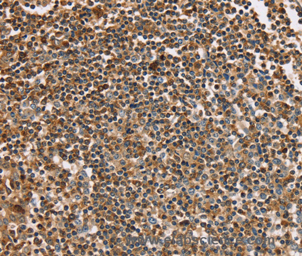 Immunohistochemistry of paraffin-embedded Human tonsil using PLS3 Polyclonal Antibody at dilution of 1:30