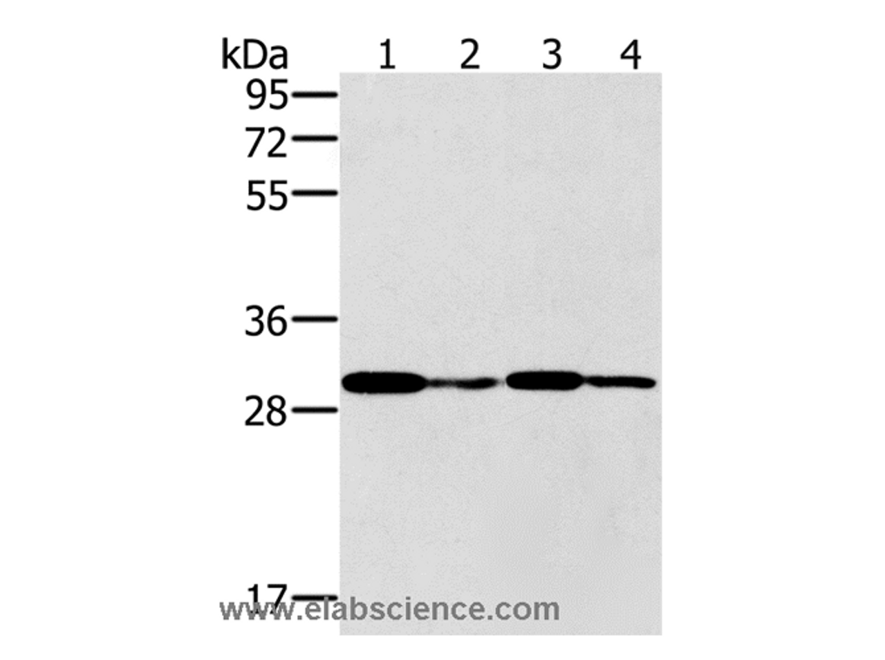 Western Blot analysis of K562 cell and Human liver cancer tissue, Jurkat and A549 cell using PNMT Polyclonal Antibody at dilution of 1:400