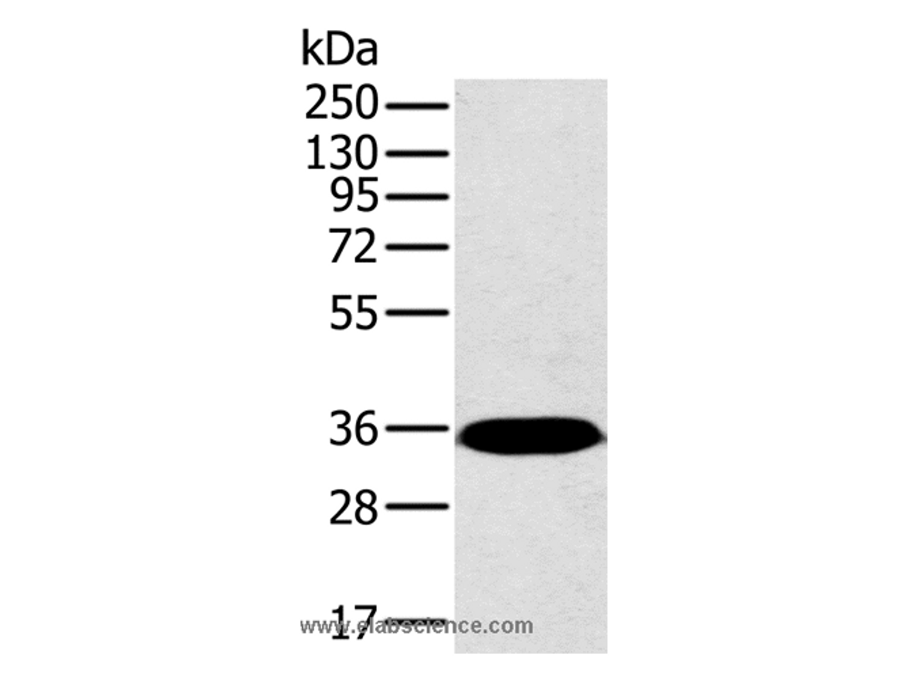 Western Blot analysis of Mouse brain tissue using PPP2CA Polyclonal Antibody at dilution of 1:450