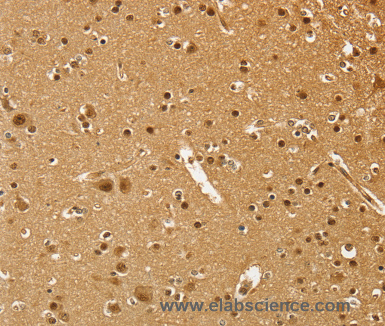 Immunohistochemistry of paraffin-embedded Human brain  using PSMC1 Polyclonal Antibody at dilution of 1:40