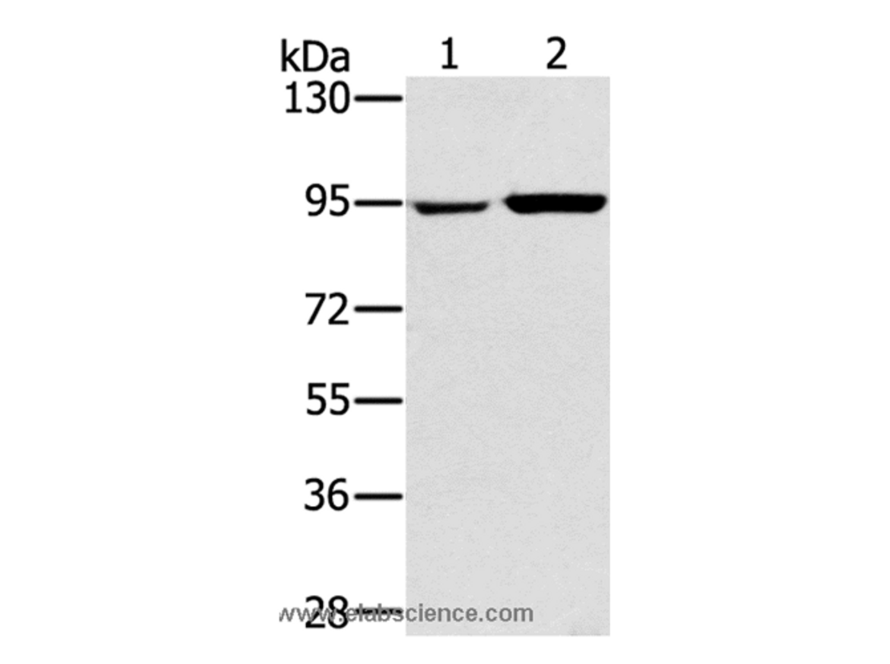 Western Blot analysis of 231 and PC3 cell using PYGL Polyclonal Antibody at dilution of 1:400